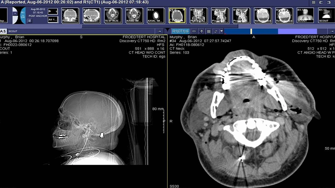 A scan of Brian Murphy's brain.
